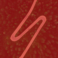 Scintillating Backdrops for Inner Peace