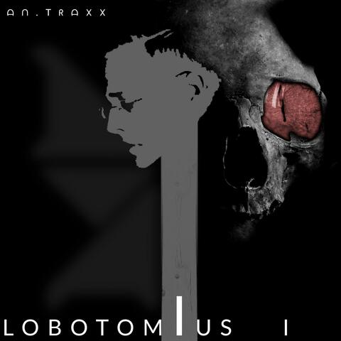Lobotomius I
