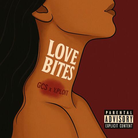 Love Bites