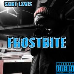 FROSTBITE