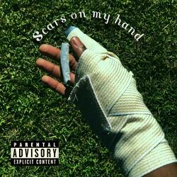 Scars on my hand