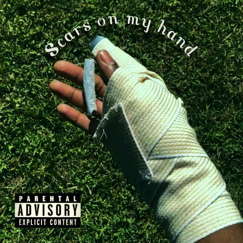 Scars on my hand
