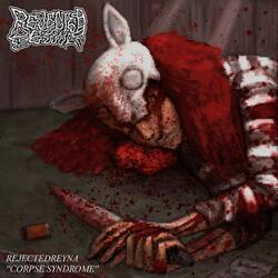 CORPSE SYNDROME