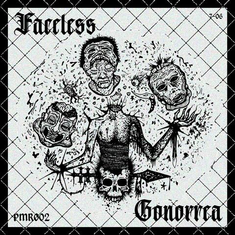 Gonorrea
