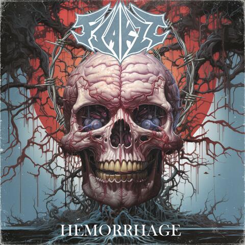 Hemorrhage