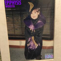 Epiphysis