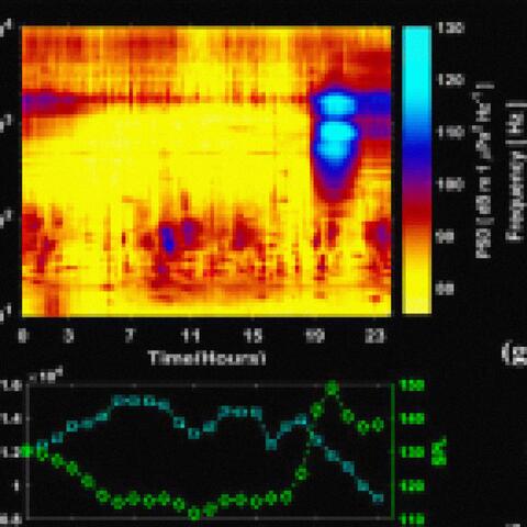 MRI Brain Wave