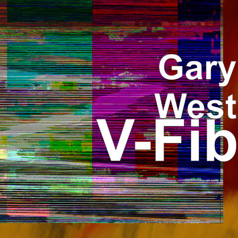 V-Fib