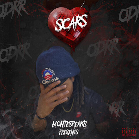 Scars