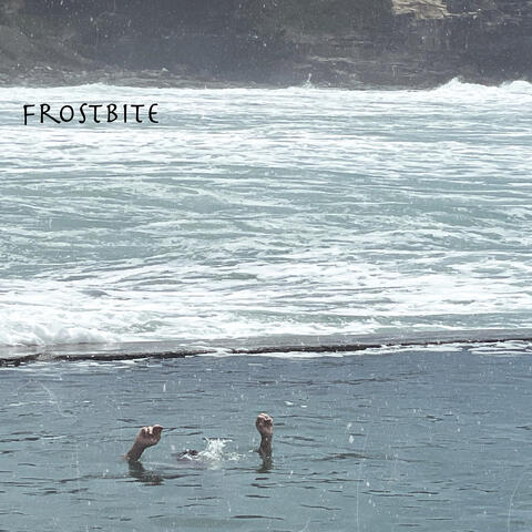 Frostbite