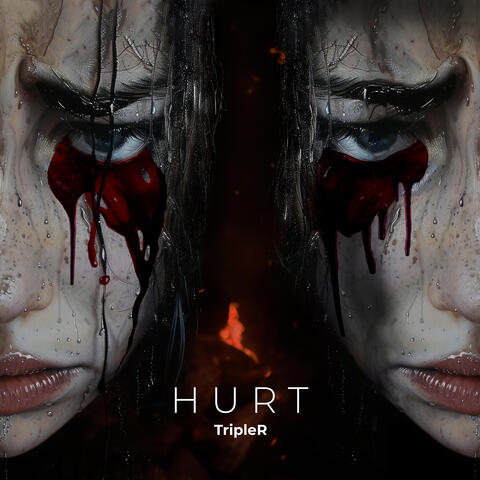 Hurt