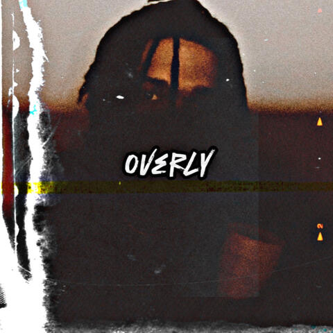 Overly