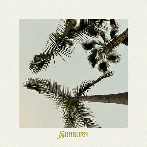 Sunburn
