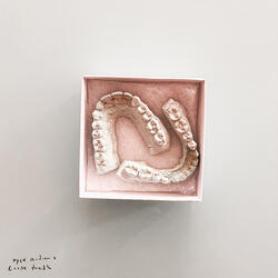 Loose Tooth