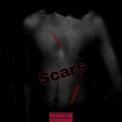 Scars