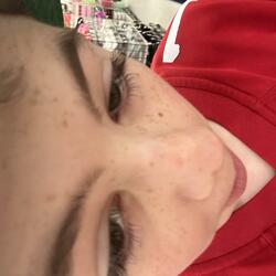 Implants At Claire’s