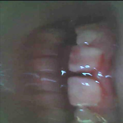 Grind Your Teeth