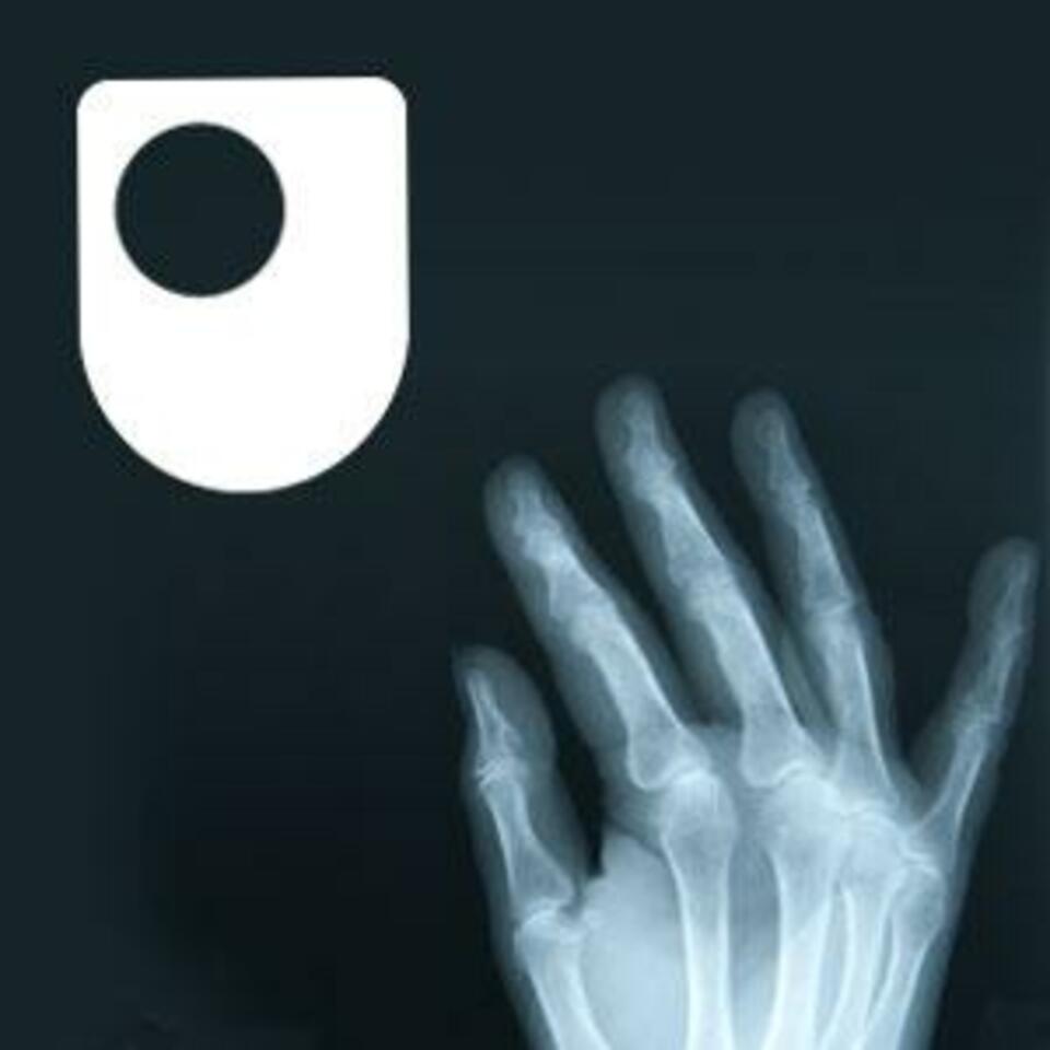 Rheumatoid arthritis - a long term condition - for iPad/Mac/PC