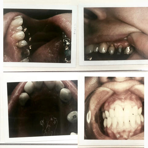freak. album art