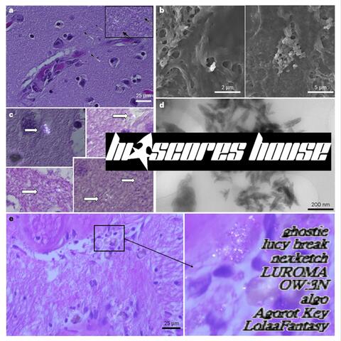 Microplastics album art