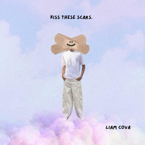 Kiss These Scars album art