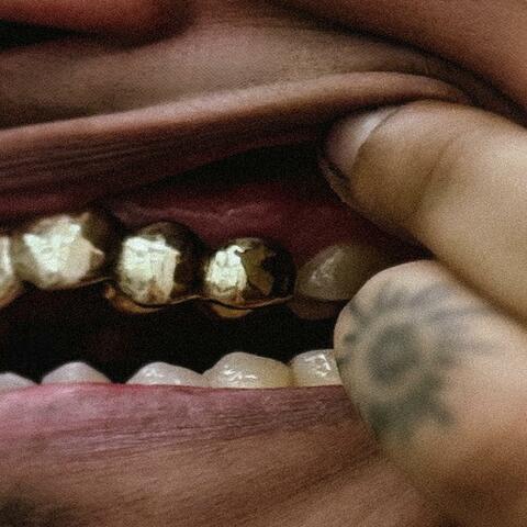 Accent album art