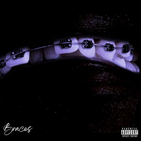 BRACES album art
