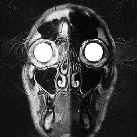 Fragen in meinem Kopf Pt. II album art