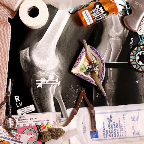 BROKEN LEG BEATS album art