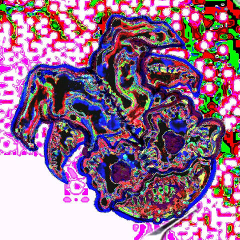 Problème/Solution/Problème/Solution album art