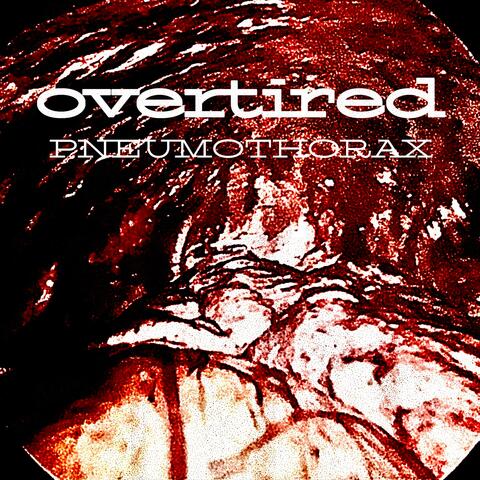 Pneumothorax album art