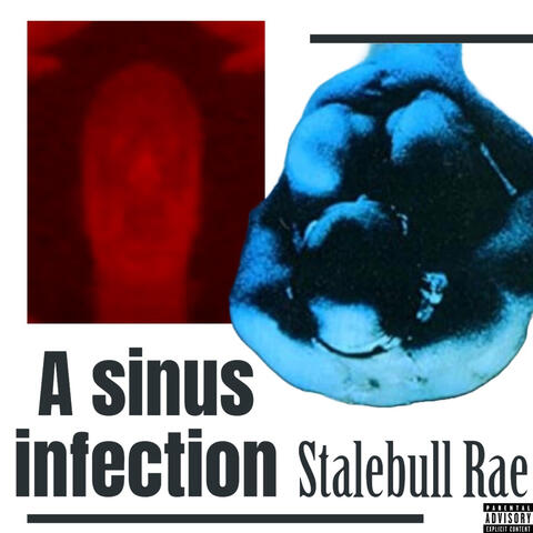 A Sinus Infection album art