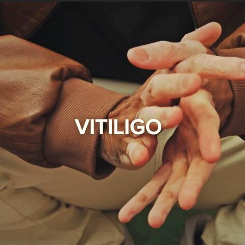 Vitiligo album art