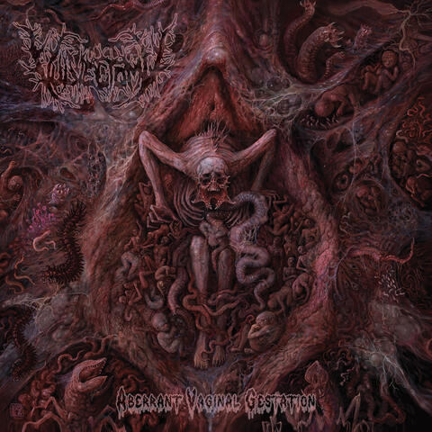 Aberrant Vaginal Gestation album art