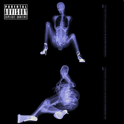 Nalg0Tica album art