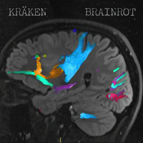 Brainrot album art
