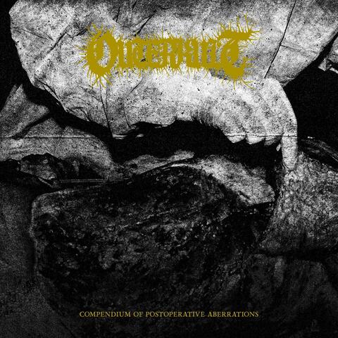 Compendium of Postoperative Aberrations album art