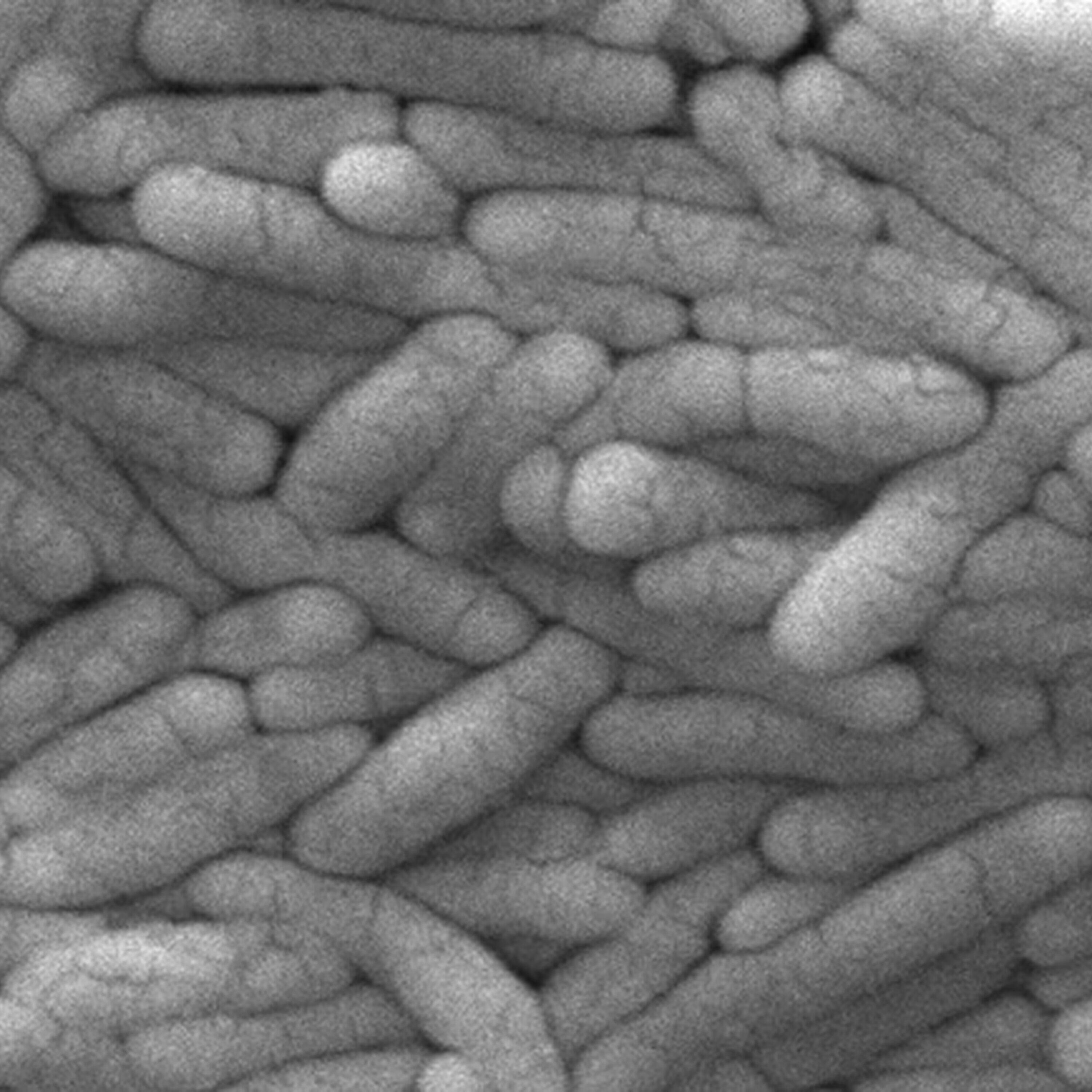 The Morning Rush - Salmonella outbreak that leaves 52 ill linked to pistachios