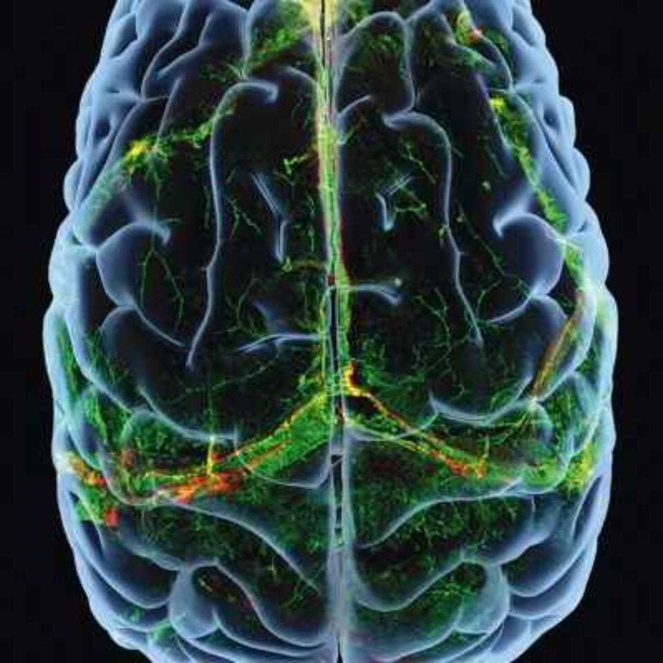 NPP BrainPod