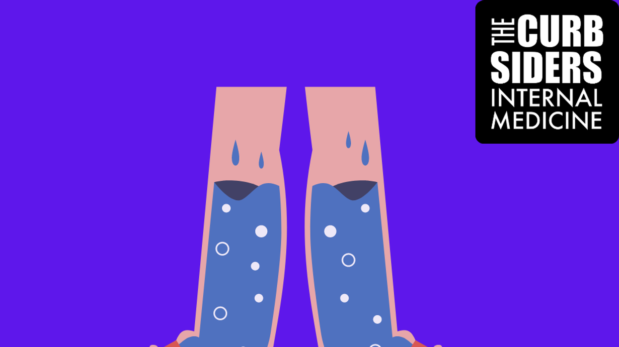 316 Lower Extremity Edema with The Curbsiders The Curbsiders
