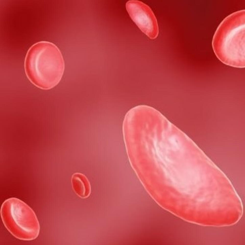 Sickle cell My Curse , My Pain, My Fear