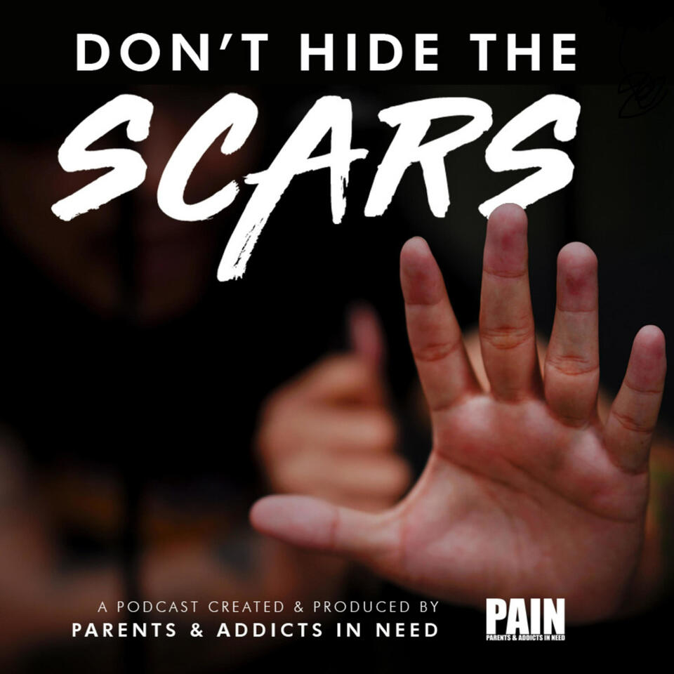 Don’t Hide The Scars. Presented By PAIN: Parents & Addicts In Need