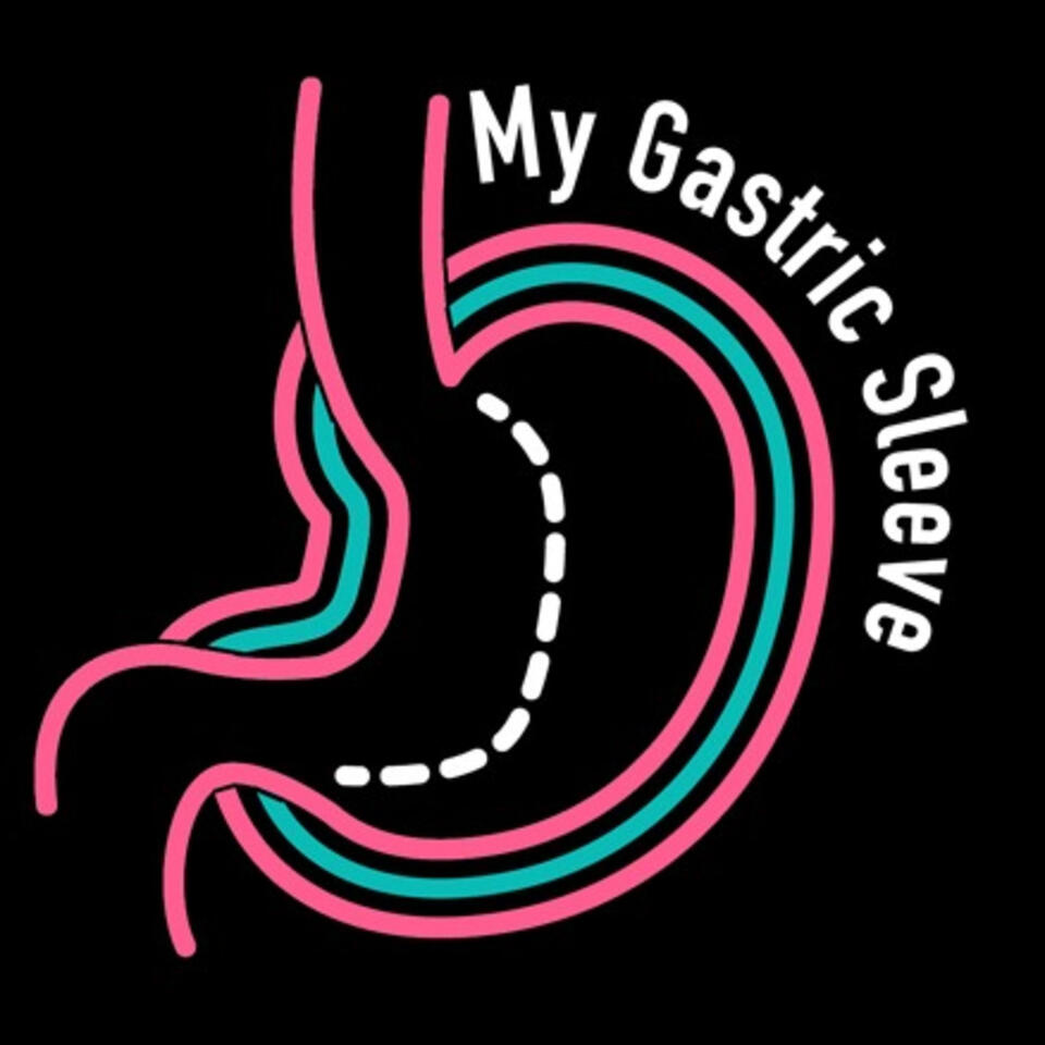 My Gastric Sleeve