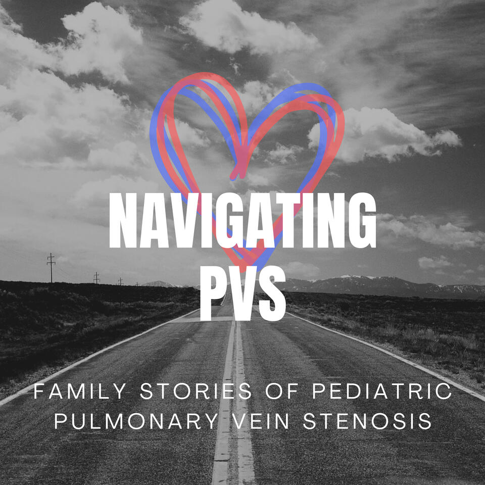 Navigating PVS