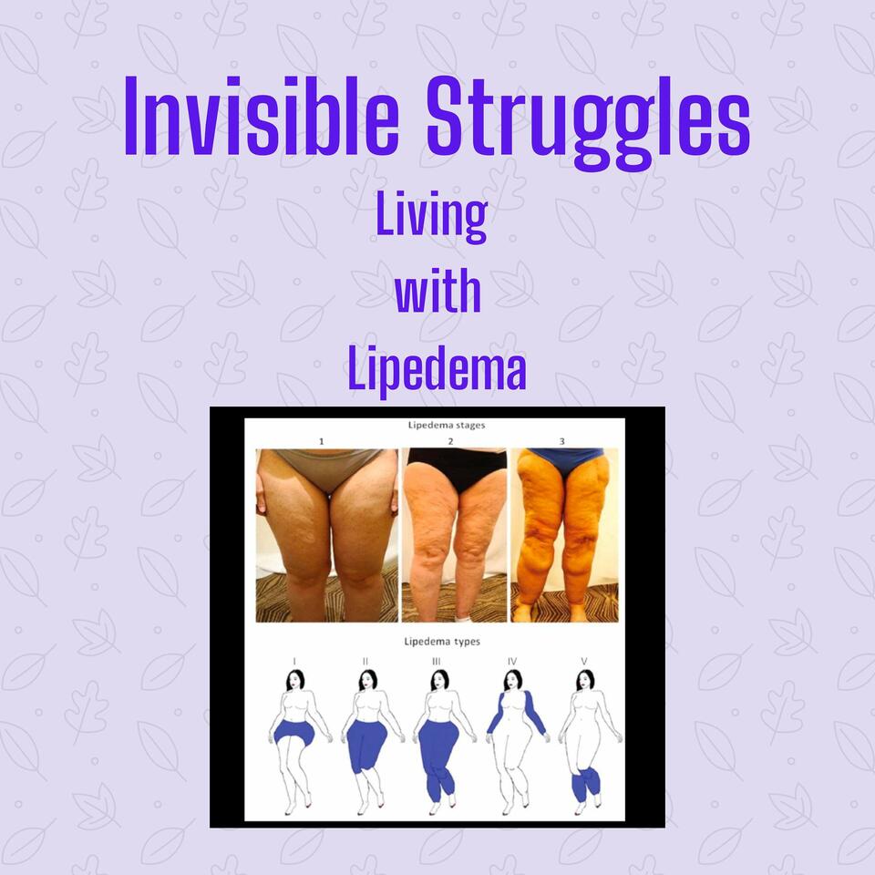 Invisible Struggles: Living with Lipedema