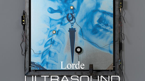 Win your way to Lorde with KIIS CLUB!